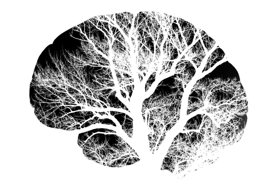 Brain 2139197 960 720